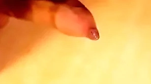 Phimosis cock excellent cumshot