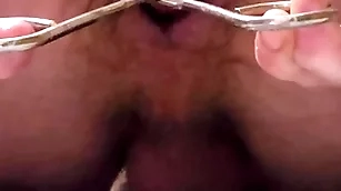Garden hose enema increased by anal dilation
