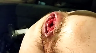 Just fisting my loose fissure and prolapse:)