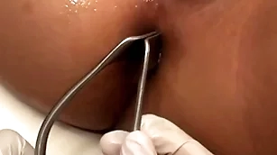 Asian patient penetrated in anal hole apart from stud in missionary